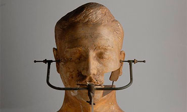 Cráneo del señor Ezequiel Tapia